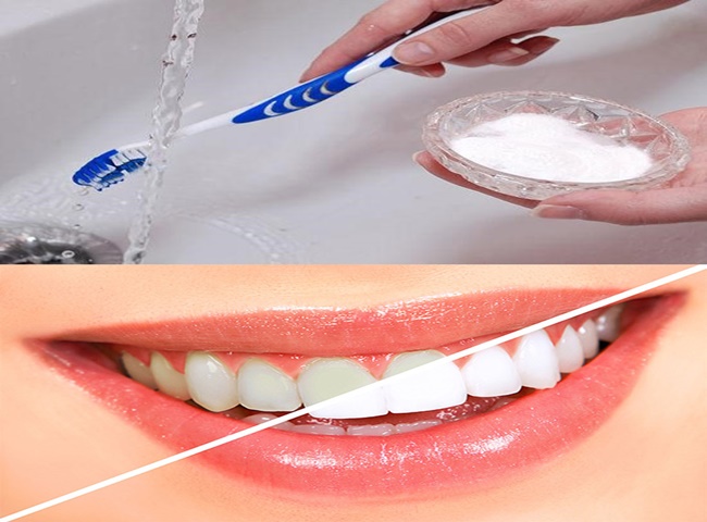 Dùng baking soda đúng cách để làm trắng răng tại nhà